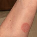 Young slim woman enjoys weight loss result